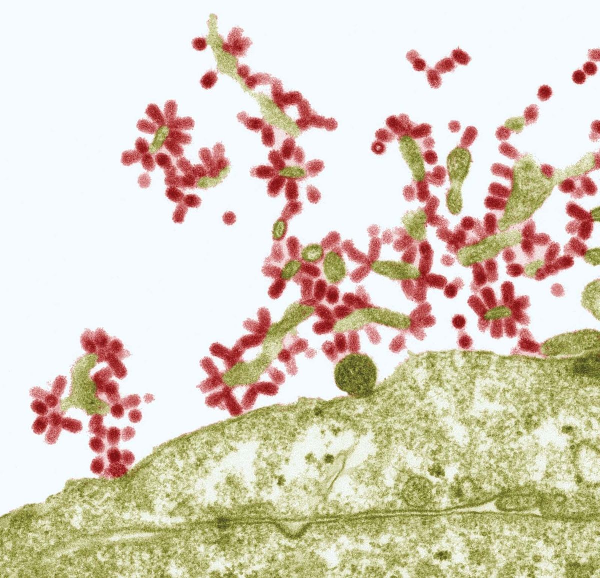 Электронная микрофотография вирусов гриппа