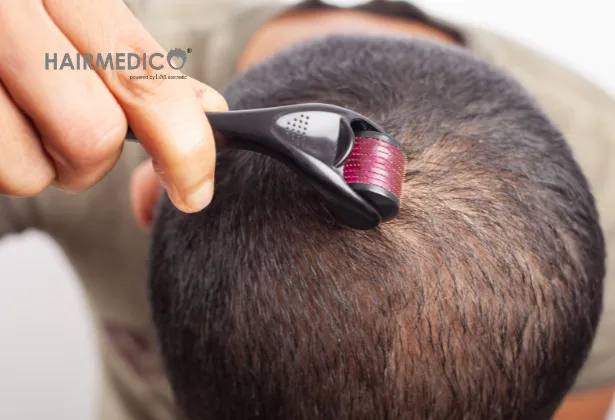 Инфографика лучших средств для восстановления волос при облысении: миноксидил, финастерид, сыворотки с пептидами и лазерная терапия